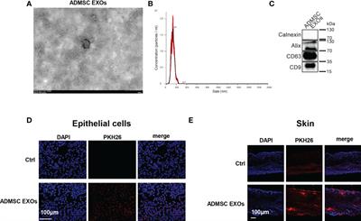 Engineered NF-κB siRNA-encapsulating exosomes as a modality for therapy of skin lesions